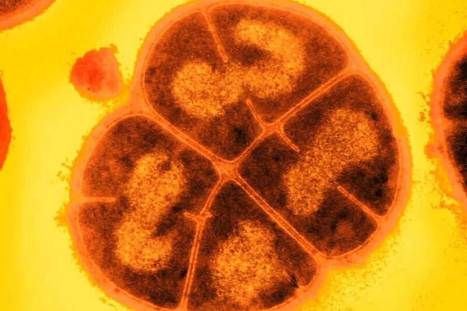 Deinococcus radiodurans, também chamado de “Conan, a bactéria”, é adequado para o ambiente hostil de Marte. Fonte: Northwestern University