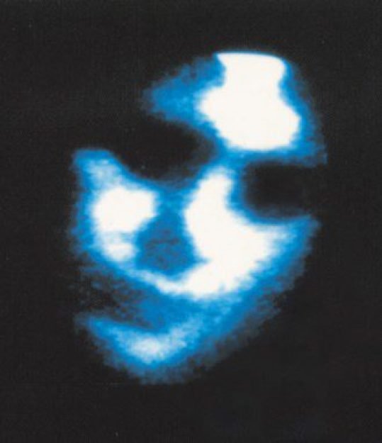 Entidade do Al&eacute;m captada por aparelhos de transcomunica&ccedil;&atilde;o instrumental